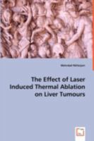 The Effect of Laser Induced Thermal Ablation on Liver Tumours 3639049802 Book Cover