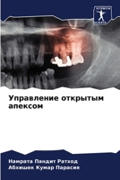 Управление открытым апексом 620609524X Book Cover