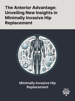 The Anterior Advantage: Unveiling New Insights in Minimally Invasive Hip Replacement 1022897667 Book Cover