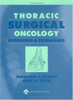 Thoracic Surgical Oncology: Exposures and Techniques 0683064290 Book Cover