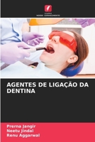 Agentes de Ligação Da Dentina (Portuguese Edition) 6207400941 Book Cover
