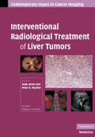 Interventional Radiological Treatment of Liver Tumors. Contemporary Issues in Cancer Imaging: A Multidisciplinary Approach. 0521886872 Book Cover