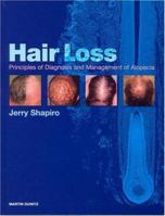 Hair Loss: Principles of Diagnosis and Management of Alopecia 1853178764 Book Cover