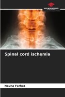 Spinal cord ischemia 6207904346 Book Cover