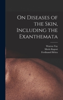 On Diseases of the Skin, Including the Exanthemata 1016507259 Book Cover