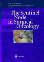 The Sentinel Node in Surgical Oncology 3642642306 Book Cover
