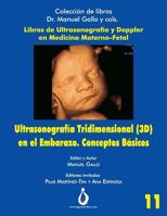 Ultrasonografia Tridimensional en el Embarazo (3D). Conceptos Básicos (Coleccion de Libros Dr. Manuel Gallo y cols) 1731579470 Book Cover