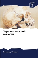 Перелом нижней челюсти 6205662752 Book Cover