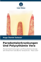 Parodontalerkrankungen Und Polyzythämie Vera 6205556693 Book Cover