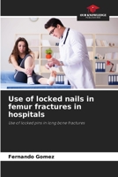 Use of locked nails in femur fractures in hospitals 6206411451 Book Cover