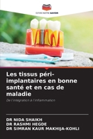 Les tissus péri-implantaires en bonne santé et en cas de maladie (French Edition) 620972602X Book Cover