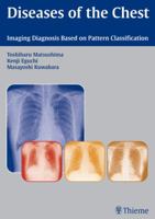 Diseases of the Chest: Imaging Diagnosis Based on Pattern Classification 1588905624 Book Cover