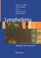 Lymphedema: Diagnosis and Treatment 1846285488 Book Cover