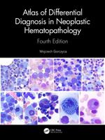 Atlas of Differential Diagnosis in Neoplastic Hematopathology 0367637294 Book Cover