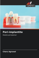 Peri-implantite 6205629879 Book Cover