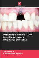 Implantes basais - Um benefício para a medicina dentária (Portuguese Edition) 6206834719 Book Cover