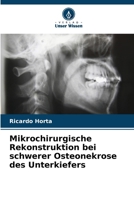 Mikrochirurgische Rekonstruktion bei schwerer Osteonekrose des Unterkiefers (German Edition) 6630093631 Book Cover