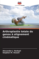Arthroplastie totale du genou à alignement cinématique (French Edition) 6208331730 Book Cover