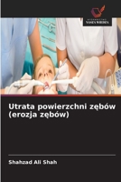 Utrata powierzchni zebów (erozja zebów) (Polish Edition) 6630184289 Book Cover
