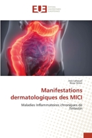 Manifestations dermatologiques des MICI 6203449938 Book Cover