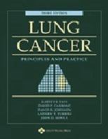 Lung Cancer: Principles and Practice 0397513615 Book Cover