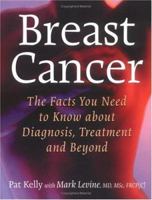 Breast Cancer: The Facts You Need to Know about Diagnosis, Treatment and Beyond 1552977382 Book Cover