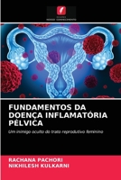 Fundamentos Da Doença Inflamatória Pélvica 6203300659 Book Cover