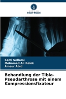 Behandlung der Tibia-Pseudarthrose mit einem Kompressionsfixateur 6206209911 Book Cover