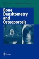 Bone Densitometry and Osteoporosis 3540631496 Book Cover