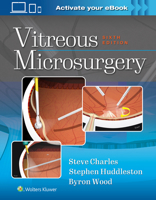 Vitreous Microsurgery 1975168356 Book Cover