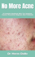No More Acne: A Complete Handbook With The Symptom, Causes, Prevention Diagnosis And Treatment B0BKN2D71K Book Cover