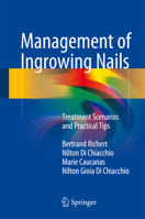 Management of Ingrowing Nails: Treatment Scenarios and Practical Tips 3319305530 Book Cover