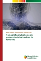 Tomografia multislice com protocolo de baixa dose de radiação 6206759415 Book Cover