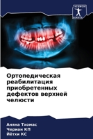 Ортопедическая реабилитация приобретенных дефектов верхней челюсти 6204154893 Book Cover