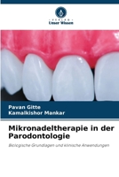 Mikronadeltherapie in der Parodontologie 6630278224 Book Cover