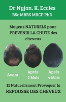 Moyens NATURELS pour Prévenir la chute des cheveux: Et naturellement provoquer la REPOUSSE DES CHEVEUX (French Edition) B0DS8LMNT7 Book Cover