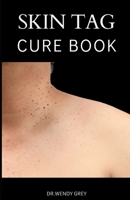 THE SKIN TAG CURE BOOK: A COMPREHENSIVE GUIDE ON HOW TO CURE SKIN TAG B0BFPCQCWG Book Cover