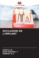 Occlusion de l'Implant (French Edition) 6207931645 Book Cover