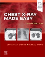 Chest X-Ray Made Easy, IE, 3e 0702082341 Book Cover