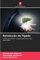 Ressecção do fígado: Formas de prevenir complicações intra e pós-operatórias (Portuguese Edition) 6205086956 Book Cover