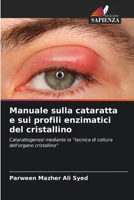 Manuale sulla cataratta e sui profili enzimatici del cristallino (Italian Edition) 6209596355 Book Cover