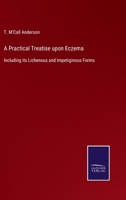 A Practical Treatise upon Eczema: Including its Lichenous and Impetiginous Forms 3752563443 Book Cover