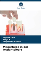 Misserfolge in der Implantologie 6206307042 Book Cover