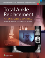 Total Ankle Replacement: An Operative Manual 1451185227 Book Cover