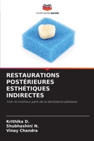 RESTAURATIONS POSTÉRIEURES ESTHÉTIQUES INDIRECTES: Tirer le meilleur parti de la dentisterie adhésive 6206049396 Book Cover