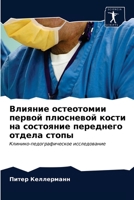 Влияние остеотомии первой плюсневой кости на состояние переднего отдела стопы: Клинико-педографическое исследование 6202750952 Book Cover