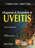 Diagnosis And Treatment Of Uveitis 9350255723 Book Cover