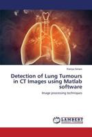 Detection of Lung Tumours in CT Images using Matlab software 3659616958 Book Cover