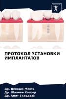 ПРОТОКОЛ УСТАНОВКИ ИМПЛАНТАТОВ 6203607495 Book Cover