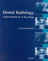 Dental Radiology: Understanding The X Ray Image 0192624105 Book Cover
